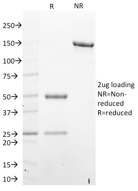 Data from SDS-PAGE analysis of Anti-STAT6 antibody (Clone STAT6/2410). Reducing lane (R) shows heavy and light chain fragments. NR lane shows intact antibody with expected MW of approximately 150 kDa. The data are consistent with a high purity, intact mAb.